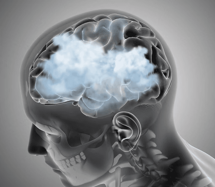 How-to-Reduce-Brain-Fog-with-Nootropics CONKA