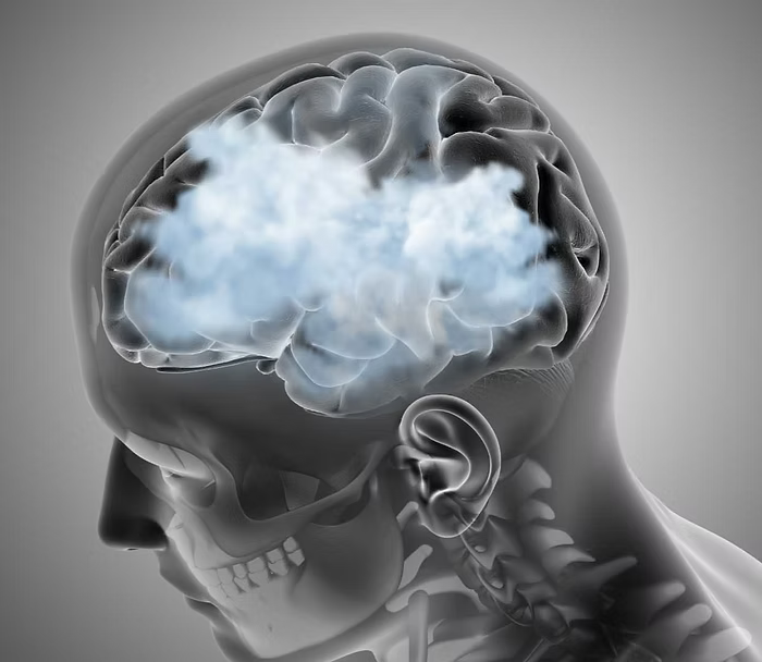 How to Reduce Brain Fog with Nootropics